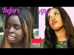 @G.m.x%+27695222391 J17@ South africa@BEST face &body whitening cream, Dark Spots/ Stretch Marks. pills, injection in Vereeniging, Orange Farm Johannesburg Lenasia Midrand