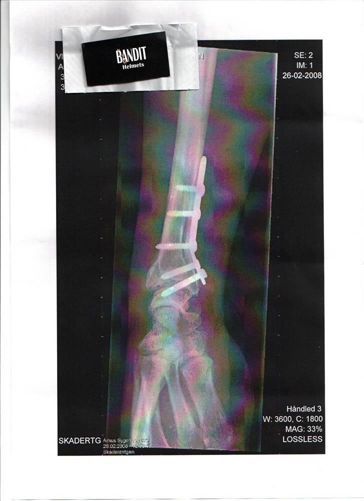 Av av.... =0( billede 1