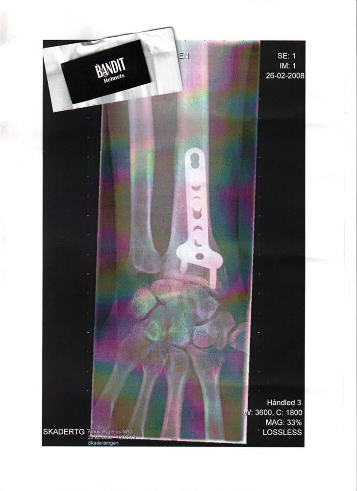 Av av.... =0( billede 2