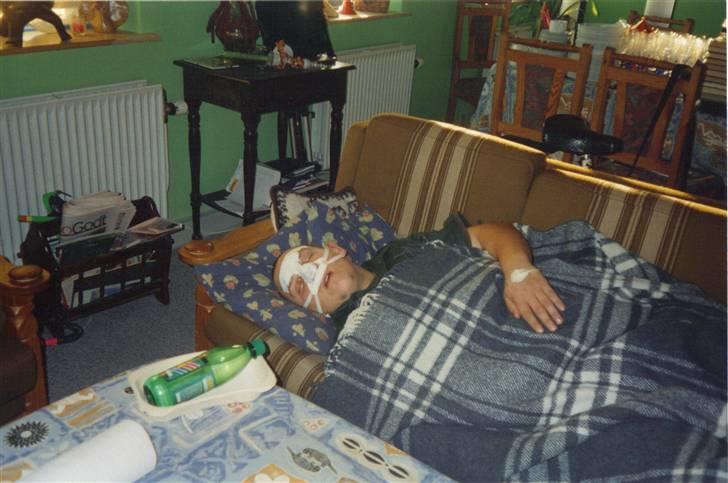 Mit uheld i 99  - 14 dage efter, næsen skulle forsøges rettes op.   hehe det lykkedes dem ikke helt. crasher på sofaen billede 6