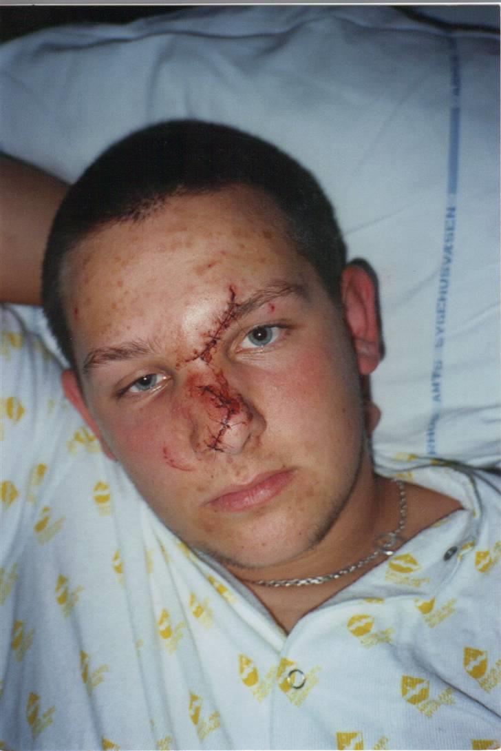 Mit uheld i 99  - Samme dag, det skete klokken 6  om morgen. kunne første  begynde at huske noget fra klokken 13. hukommelsen var noget rusten 4 uger efter. billede 7