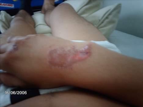 Aprilia Rs 125 [DØD] billede 15