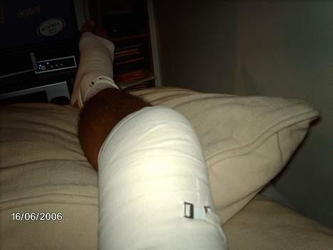 Aprilia Rs 125 [DØD] billede 17