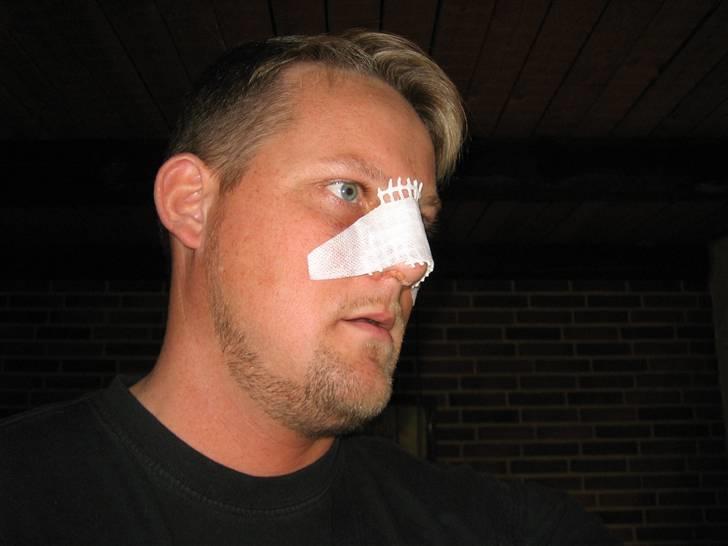 Kawasaki ZZR 1400 (solgt) - Sådan så jeg ud (nej der kommer ikke et billede af Pipfuglen) billede 9