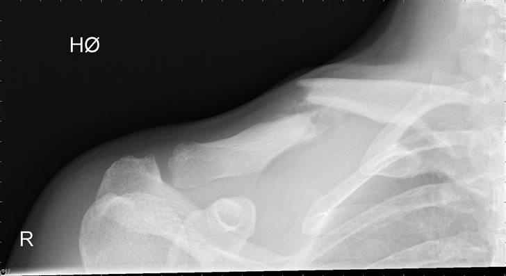 Suzuki sv650 - det kommer der at vælte i et sving, så det gør jeg forhåbendlig ikke igen. :~) billede 9