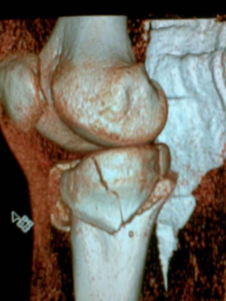 Honda CRF 450 R - Et lille styrt billede 12