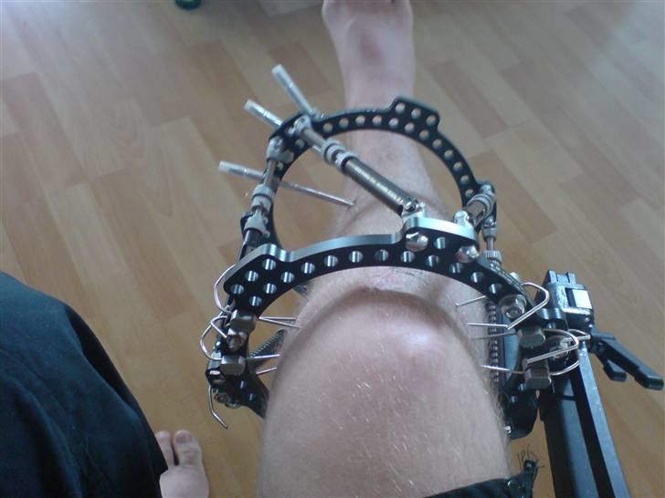 Honda CRF 450 R - Et lille styrt billede 13