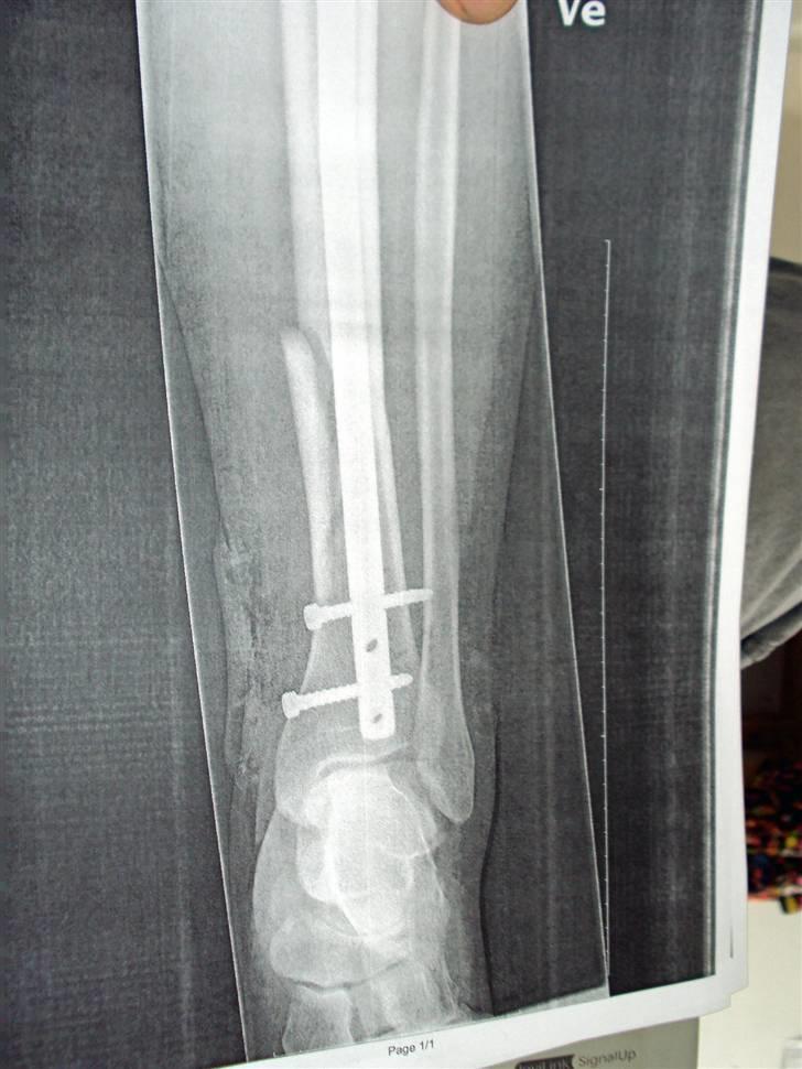 Suzuki Gixxer bandit - Resultat efter god dag på Jyllandsringen billede 6