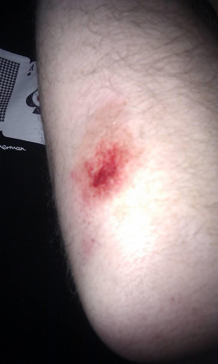 Aprilia sxv 450 - Første træning.... Brændmærke gennem læderdrageten. billede 10