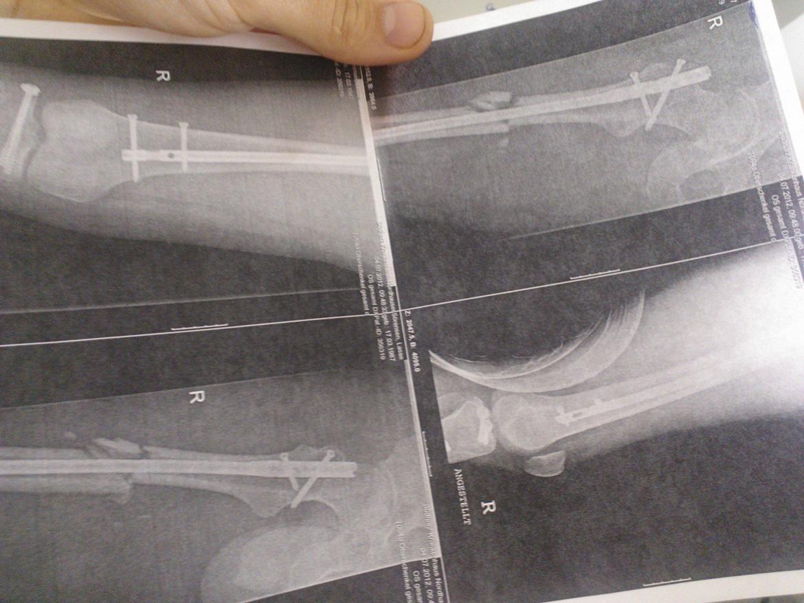 Suzuki GSXR 1000( TOTALSKADET) billede 15