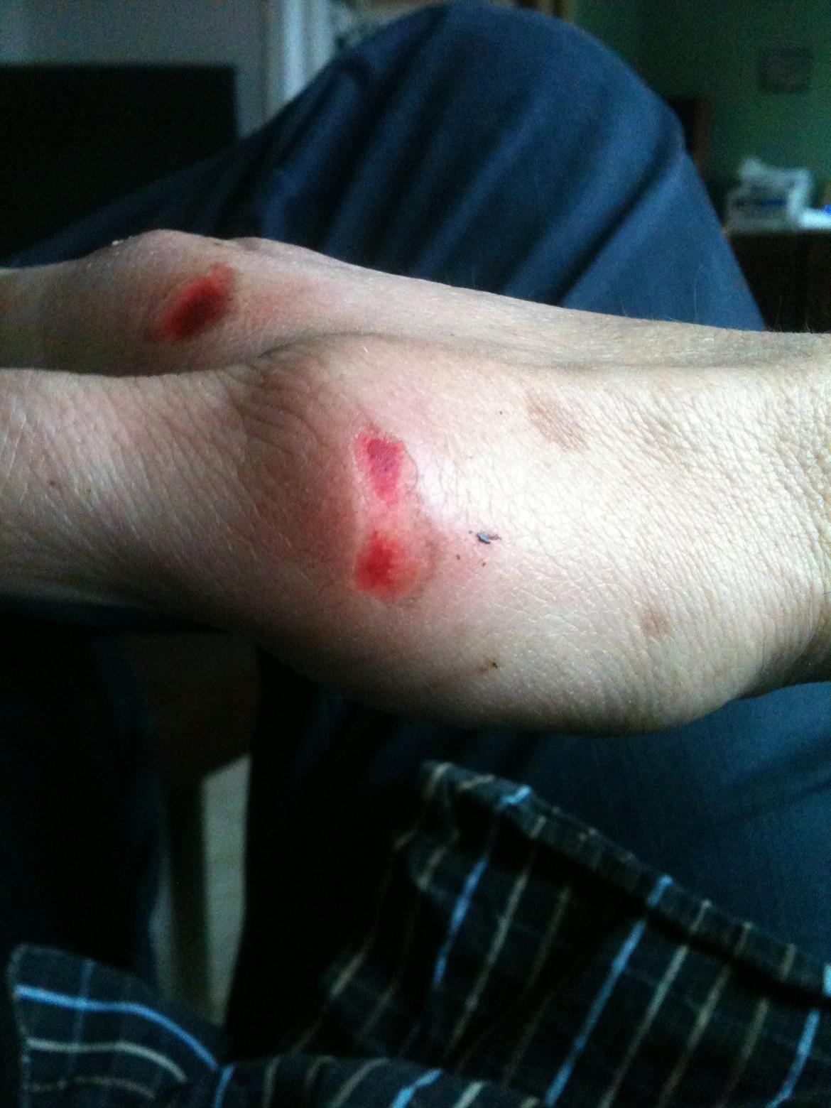 MZ ES 150/1 - besynderlige steder at få skrabt huden af billede 16