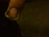 Min finger som blev hakket a :/ 