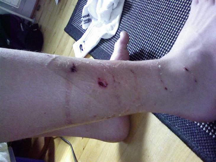 {{currentPhoto.altText}} billede {{currentPhoto.number}}