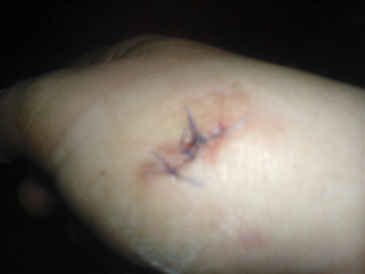 Maskinpartner A/S i Billund - Sådan går det når man ikke passer på. 3½ dag regner jeg med at være sygemeldt billede 14