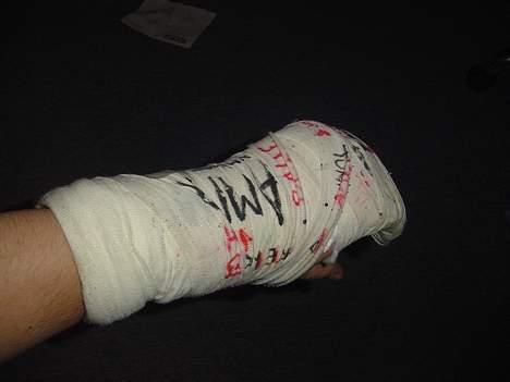 Suzuki RMX(NOS)(FØR) - D 1 dec brækker jeg min arm og får gibsen af om 1 måned - så mit projekt står lidt stille fortiden.. billede 16