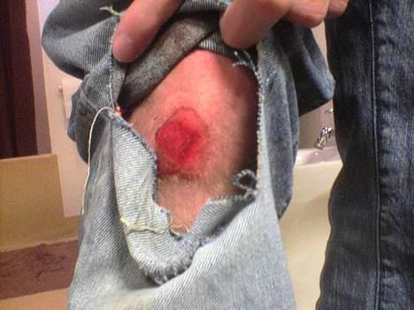 Rieju RS2 Matrix SOLGT - Og nej, der var ikke noget hul i bukserne før! billede 20