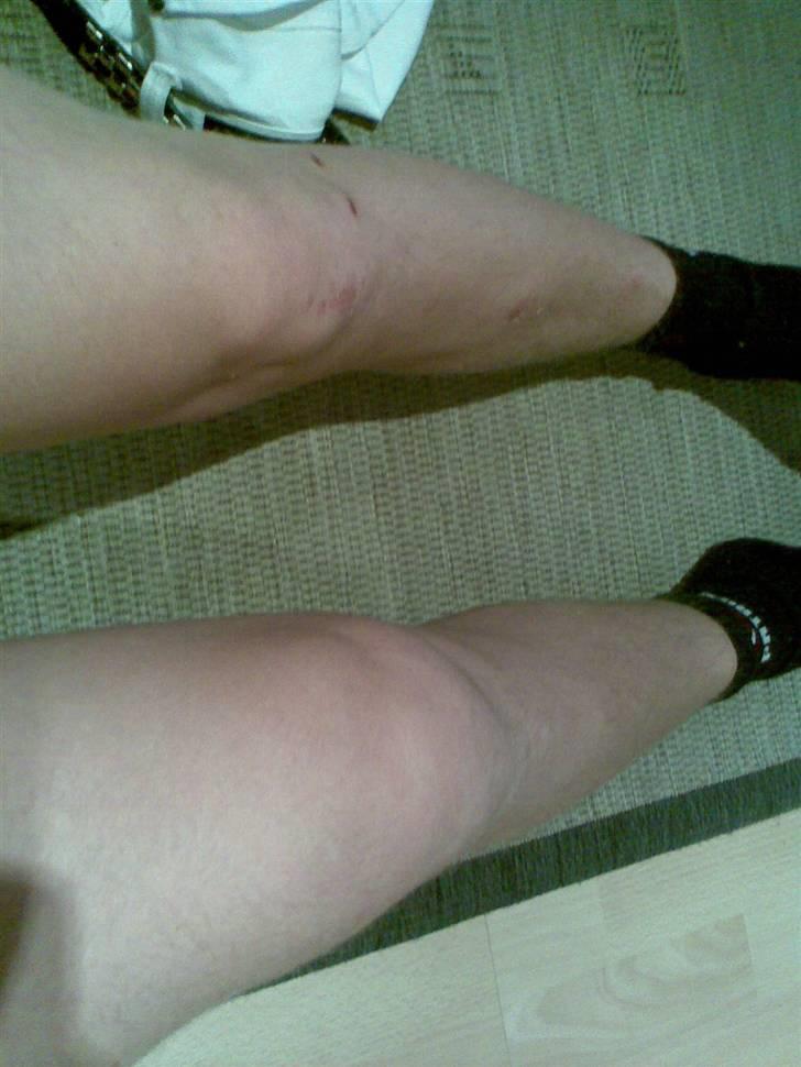 MiniBike pitbik DCSHOECOUSA SOLGT - tjek højre knæ ! ja så galt kan det gå ! ingen cross i et år fra nu ! ska opereres d. 14 november først ! billede 16