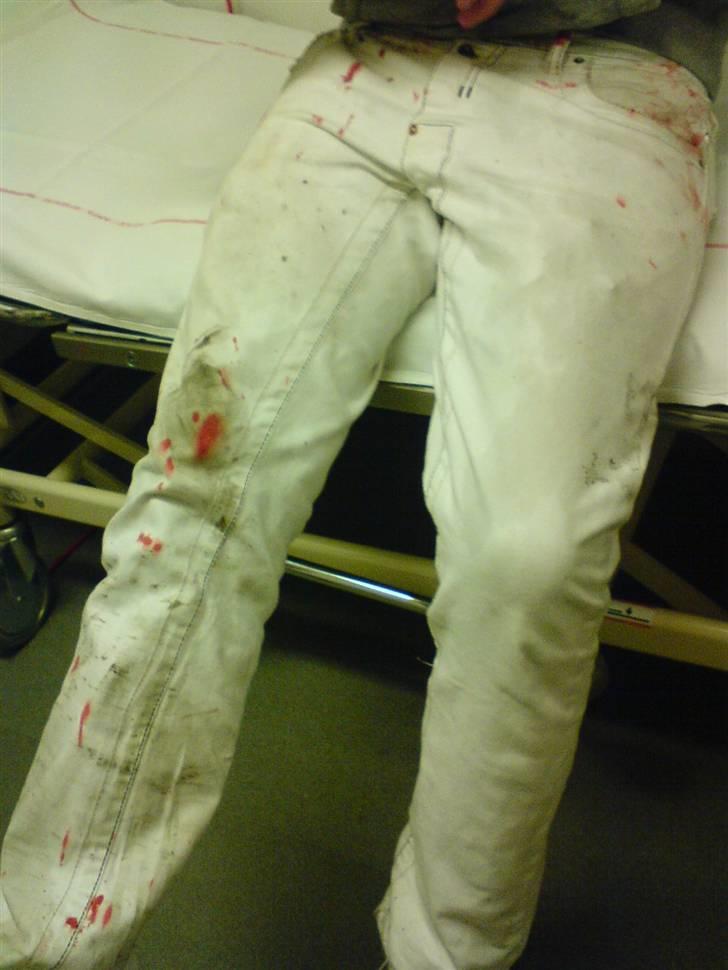 Honda Sfx byttet til Street - Efter mit styrt på sfx¨en billede 14