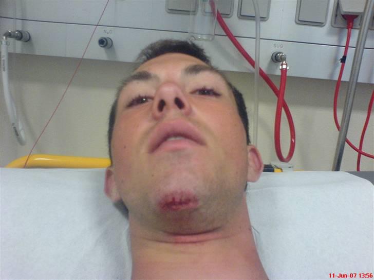 Yamaha jog - da jeg kørte ind i en bil røv  billede 3