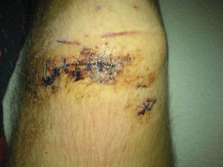 Suzuki Street Magic [Solgt] - ´ 10 Sting Pga En Som Kørte Ind I Mig :/ .. billede 11