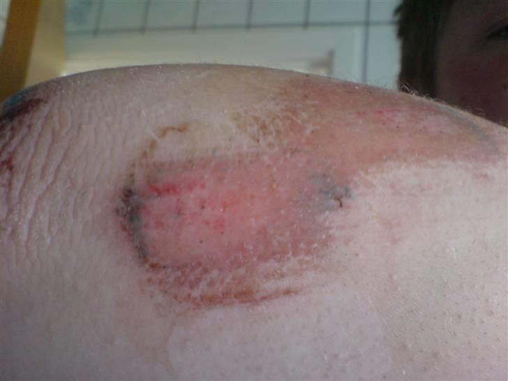 Piaggio Zip solgt 3500 - Der er mer ned af amen D: billede 9