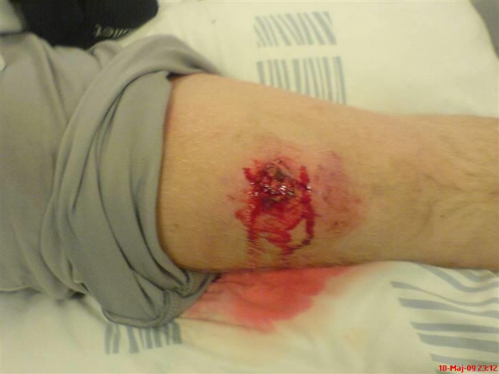 Benelli 491 ST Solgt i dele - simons knæ 7 Sting billede 18