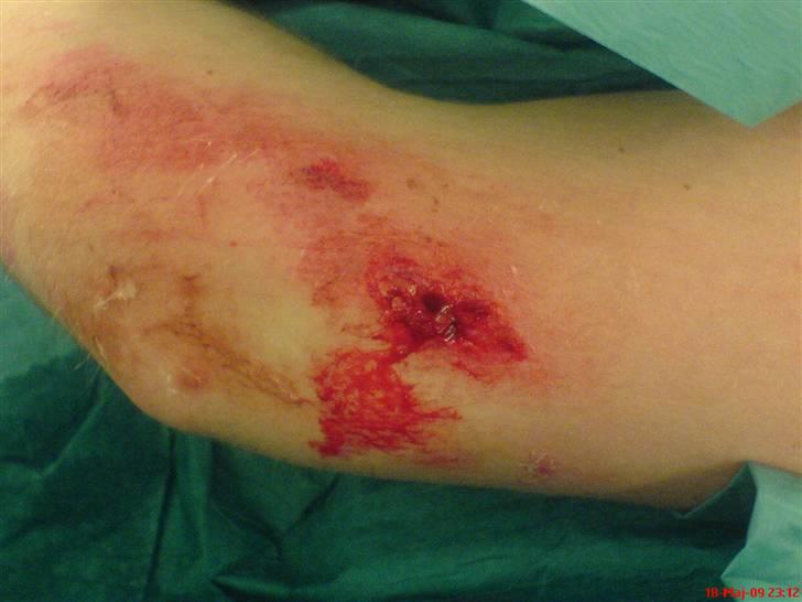 Benelli 491 ST Solgt i dele - simons arm 3 sting billede 19