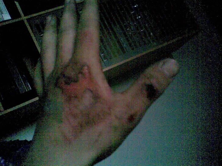 Yamaha jog as ( SOLGT ) - da jeg fløj bagover med 70 !!! :P havde ingen skjolde på scooteren og det var kun sædet der gik i stykkker har et nyt liggende  billede 13