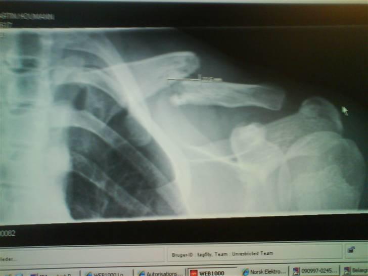 Kawasaki Kx 125 - efter et lille styrt i lindknud billede 11