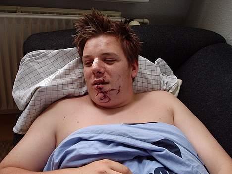 Peugeot SPEEDFIGHT LC 30 (SOLGT) - efter politiet påkørte mig..!  billede 17