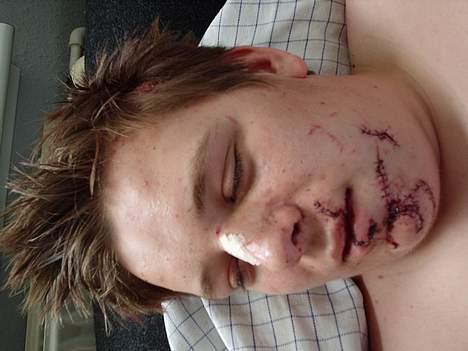 Peugeot SPEEDFIGHT LC 30 (SOLGT) - efter politiet påkørte mig billede 18