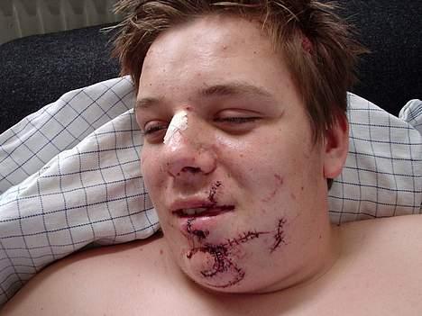 Peugeot SPEEDFIGHT LC 30 (SOLGT) - efter politiet påkørte mig billede 19