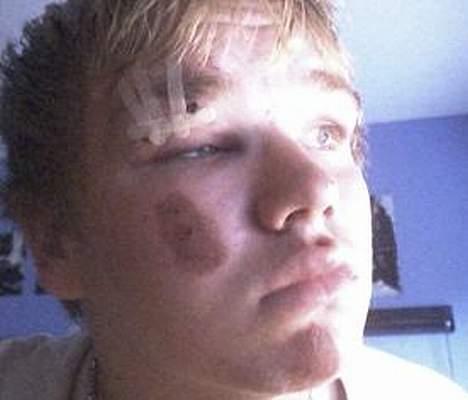 Yamaha Jog - Solgt - Byttede joggen og min maxi til sonic, og om aftenen da jeg havde fået den chrashede jeg med en kammi ! sådan ser det så ud ;D billede 9