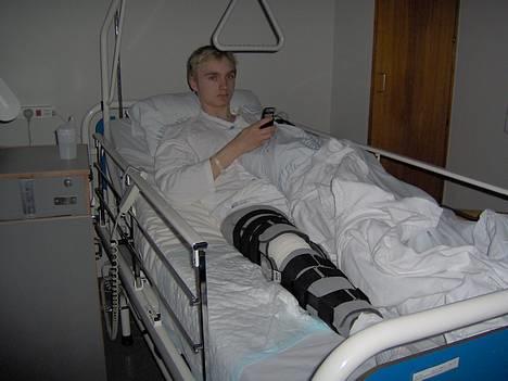 Gilera Stalker -¦ Solgt ¦- - Sån så Champen ud d.26.01 på Næstved Hospital - Ska rende rundt med den skinde i 5-6 uger ! billede 7